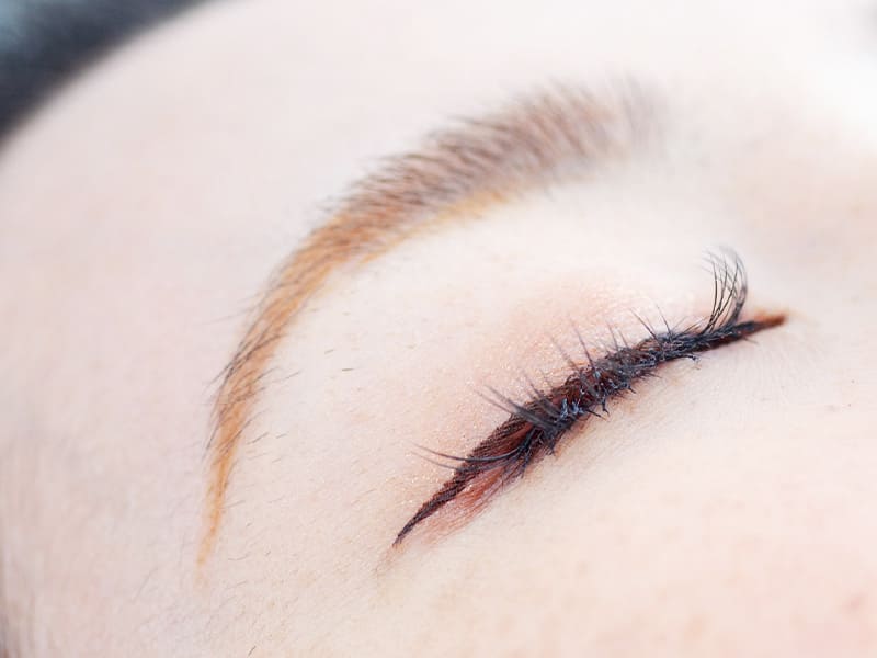 ハリウッドブロウリフトの施術イメージ